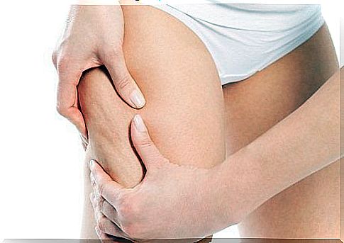 Woman in need of anti-cellulite treatments with apple cider vinegar