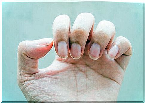 Natural treatments for fragile nail problems