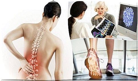 Bones attacked by diseases that cause back pain