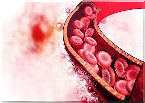 Diagnosis and treatment for fibromuscular dysplasia