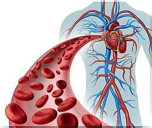 The need for treatment for fibromuscular dysplasia