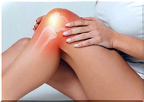 Woman who has a sprained knee