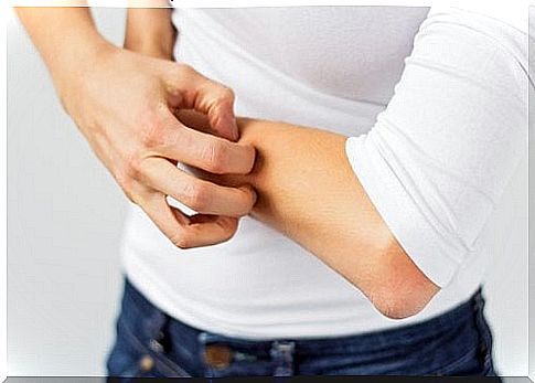 Itching can be a seamn regarding the accumulation of toxins