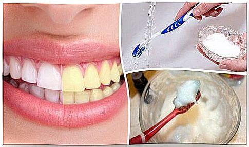 Natural teeth whitening products such as baking soda