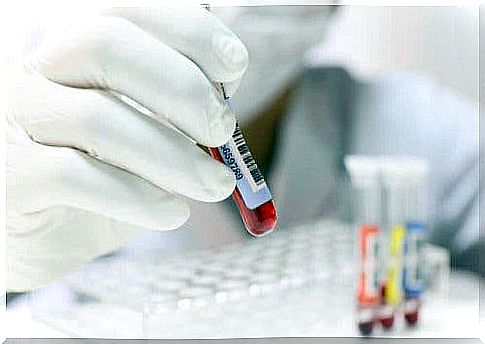 Laboratory assistant analyzing blood samples