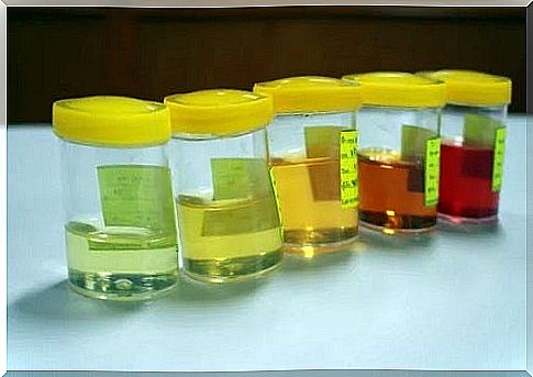 Changes in urine: reasons for concern