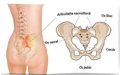 Drawing illustrating the location and structure of the sacroiliac joint